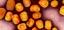 Berlin: Charité-Forscher weisen hohe Wirksamkeit von Mpox-Impfung nach