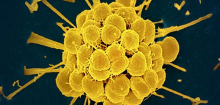 Tripper: Neu entwickeltes Antibiotikum wirkt gegen resistente Erreger