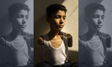 Najbolja novinska fotografija u svijetu prikazuje palestinskog dječaka koji je ostao bez obje ruke u ratu u Gazi