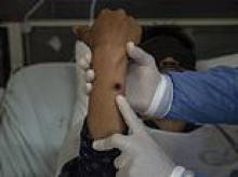 Rare strain of disease confirmed in Australia for just the second time