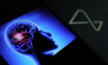 Neuralink ugradio moždani implantat još dvojici pacijenata: 'Pomoći ćemo milijunima'