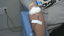 Lajmska bolest izaziva niz zdravstvenih problema, a dobija se ujednom krpelja! Doktori za Kurir o opasnosti i simptomima: Dolazi do poremećaja srca i mozga!