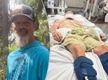Surgical assistant instantly paralyzed from neck down after freak accident involving two feet of water