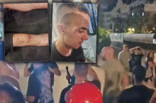 NAPADNUTA EKIPA INFORMERA! Blokaderi u Novom Sadu pokazali još jednom da im je nasilje jedini manir! (FOTO)