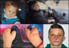 Aleksandar je imao 2 godine kada mu je vatra spržila lice, a lekari amputirali sve prste na rukama: Bio sam klinički mrtav, ali se desilo čudo!