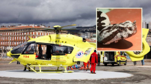 Dječaku kojeg je ugrizao poskok u Istri otkazivali organi. Brzom akcijom liječnici su ga spasili