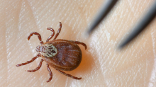 Zecken: Borreliose-Fälle nehmen weiter zu