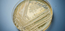 Candidozyma auris: Infektiöser Pilz breitet sich in Europa aus - wie gefährlich ist das?