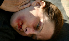 Krvave žene u modricama leže usred Zagreba: Nasilje nije eksces, nego društveni ugovor