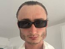 Boxer who has spent years bare-knuckle fighting is taunted by strangers after developing a square head from his injuries