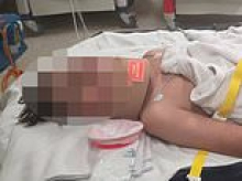 Horror as two boys, 13, attacked by masked teens while riding their e-bikes - with one suffering from critical injuries after a terrifying pursuit