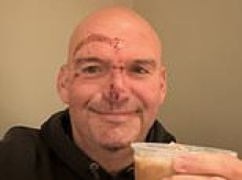 Fetterman shares smiling selfie of stitched up face after life-threatening heart problem causes fall