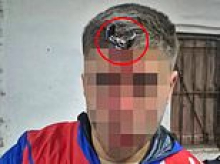 In me head, son! Car key ends up embedded in footballer's forehead after fight between players