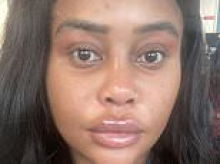 I spent £50,000 on a FACELIFT before my thirtieth birthday - people think I'm mad but it was worth every penny