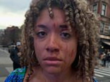 Conservative pro-life influencer sues vile woman filmed punching her on street over her views after woke Manhattan DA refused to press charges