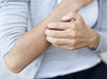 What can I do about this itching all over my head and body? DR MARTIN SCURR has the answer