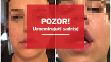 Ovo su žrtve estetskog kirurga iz Zagreba. Htio ih je ušutkati. Stigla mu je prva kazna