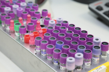 Blutlabore im Clinch: Warum Steirerblut in Wien mehr wert ist