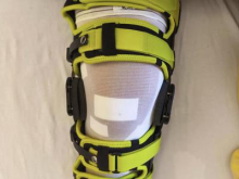 Rok Ažnoh: Zgodnje božično darilo, operacija je uspela brez zapletov