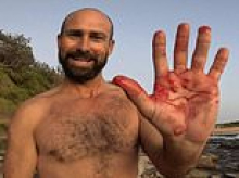 Brave surfer's instinctive act after he survived a terrifying encounter with shark at Little Avalon Beach:  'Go buy yourself a lottery ticket'