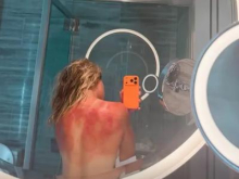 Renata Zarazua je občutila nevarno avstralsko sonce