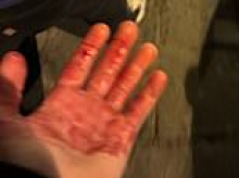 Two Chelsea fans 'stabbed' in Naples after being 'chased by 25 ultras', with one victim sharing picture of his blood-soaked hand as club warn supporters to take extreme caution