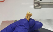 Znanstveniki odgovorili na 1500 let staro vprašanje: katera bakterija je botrovala prvi pandemiji?