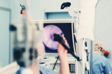 Darmkrebs: Vorsorge startet, aber schon jetzt lange Wartezeiten auf Koloskopie