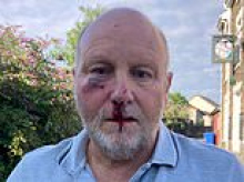 Road rage van driver who fractured grandfather's cheek and eye socket when he punched him for obeying 20mph speed limit avoids prison