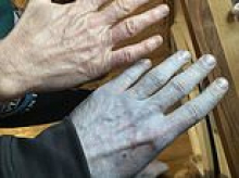 Man is rushed to hospital after his skin turns BLUE - only for medics to start laughing at real reason