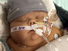 Parents distraught after hospital takes severely ill baby son with Down syndrome OFF liver transplant wait list as he lies on ventilator