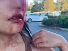 Canberra on edge after woman randomly bashed and threatened with a knife by another female in vile racist attack