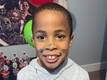 Incredibly brave boy, 10, seen for first time since medical jet crash that burned 90% of his body