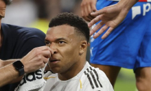 Mbappe objavio fotografiju glave: Pogledajte ozljedu za koju nije dobio penal