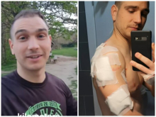 Jeziv napad na Fruškoj gori: Psi bez povoca izujedali triatlonca - Nenad završio u Urgentnom centru