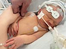 Midwife put 'blue and floppy' newborn on mother's chest and said 'there's your baby' after home birth, inquest hears