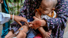 Bangladesch verzeichnet mehr als 220 Todesfälle durch Masern seit März