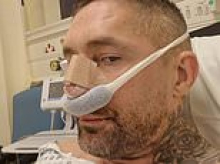 Cocaine burned a giant hole in Alan's nose. Just a few lines can do the same - if you've ever taken it this is what you must do: A top surgeon's chilling warning