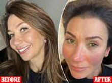 I visited Queen Camilla's beauty therapist for THIS subtle but permanent treatment that's made me look younger and prettier from the minute I wake up