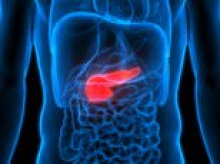 New test for symptomless pancreatic cancer has 97 per cent accuracy, fuelling hopes deadly disease could be caught in earliest stages