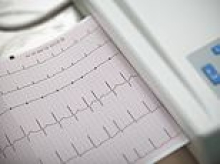 Experts pinpoint the exact heartbeat ranges that signal stroke risk... how does YOURS measure up?