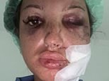 Backpacker 'left for dead' after fellow Brit crashes motorbike with her on the back 'and flees' is stuck in Thailand with huge medical bill after insurance blunder
