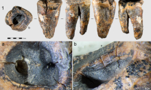 Znanstvenici imaju dokaze: Neandertalci su prije 59 tisuća godina imali - zubare