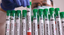 Jedan Kanađanin pozitivan na hantavirus: Bio je na kruzeru na kojem je izbila zaraza...