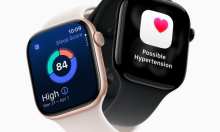 Što donosi sljedeći Apple Watch? Insajderi najavljuju dugo tražen senzor