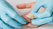 Splitter, Schnitte, Stacheln: Ein Handchirurg erklärt, wann kleine Wunden gefährlich werden