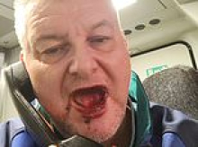 Train fare dodger who knocked out ticket inspector's tooth after punching him is spared jail