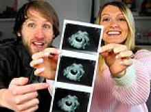 Internet star couple share video explaining that they terminated pregnancy because fetus had Down syndrome... now they've received death threats