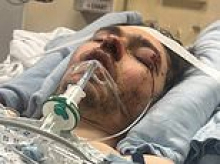 Moment man, 22, is mowed down by a drunk and drug-fuelled motorbike rider in horror hit-and-run crash that left him with life-changing injuries