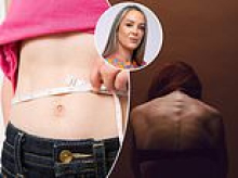 LISA BRADY: Eating disorders predominately affect females. As a mother of two young daughters, I find that terrifying... but not surprising. Ireland has never had an unblemished record with women's health